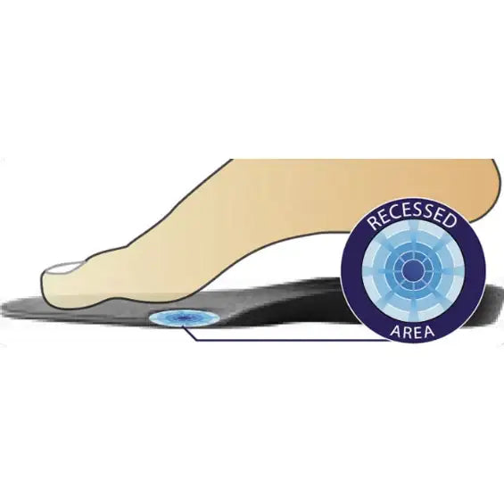 DonJoy® Arch Rival - One Pair - Supply DME