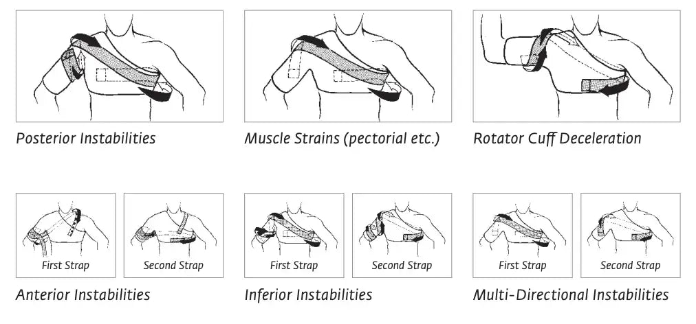 DonJoy® Sully Shoulder Stabilizer Brace - Supply DME